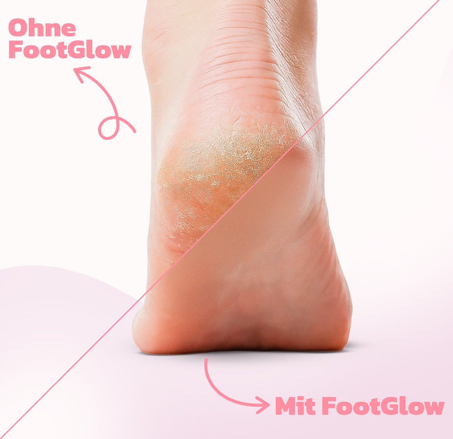 FootGlow™